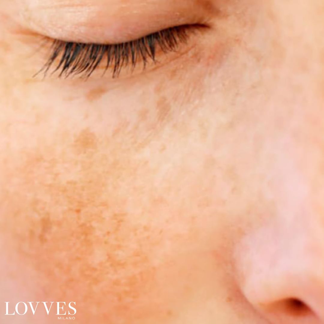 Depigmenting Face Spot Lightening Serum