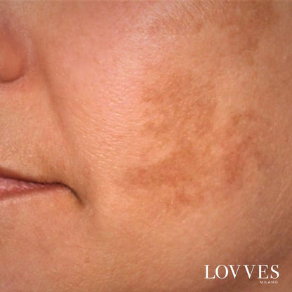 Depigmenting Face Spot Lightening Serum