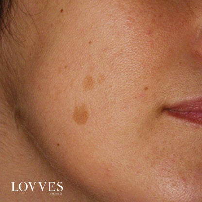 Depigmenting Face Spot Lightening Serum