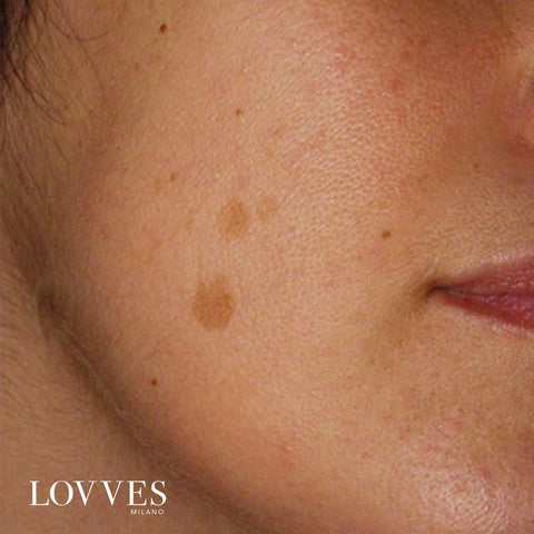 Depigmenting Face Spot Lightening Serum