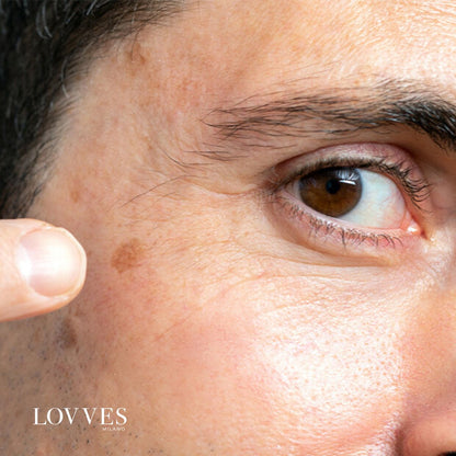 Depigmenting Face Spot Lightening Serum